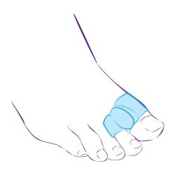 СТ-54.2 Межпальцевая перегородка с кольцами СТ-54.2 Межпальцевая перегородка с кольцами