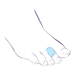 СТ-45 Приспособление корригирующие (кольцо защитное) СТ-45 Приспособление корригирующие (кольцо защитное)