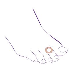 СТ-63 №9 Антимозольное кольцо СТ-63 №9 Антимозольное кольцо