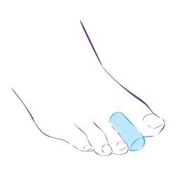 СТ-44 Приспособление корригирующие (колпачок защитный) СТ-44 Приспособление корригирующие (колпачок защитный)