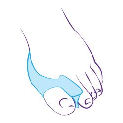 СТ-52 Межпальцевая перегородка, совмещенная с протектором сустава СТ-52 Межпальцевая перегородка, совмещенная с протектором сустава