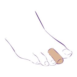 СТ-66 Приспособление корригирующее (тканевый колпачок) СТ-66 Приспособление корригирующее (тканевый колпачок)