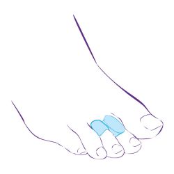 СТ-54.6 Перегородка межпальцевая с протектором,совмещенная с протектором сустава СТ-54.6 Перегородка межпальцевая с протектором,совмещенная с протектором сустава