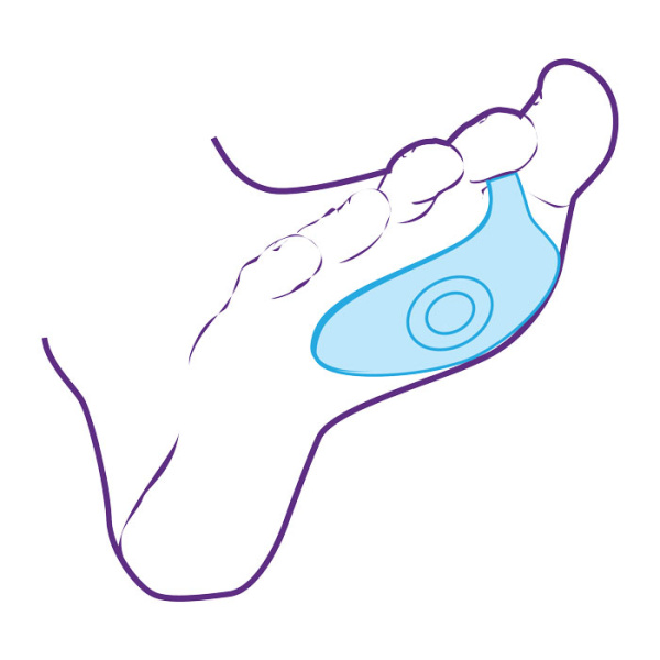 Плюсневая подушечка СТ-33  Trives Плюсневая подушечка СТ-33  Trives