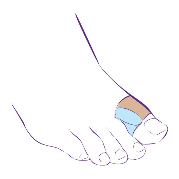 Перегородка межпальцевая с петлей на первый палец стопы на тканевой основе СТ-54.5  Trives Перегородка межпальцевая с петлей на первый палец стопы на тканевой основе СТ-54.5  Trives