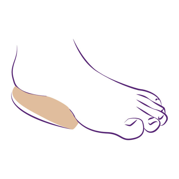 Подпяточники ортопедические амортизирующие СТ-234  Trives Подпяточники ортопедические амортизирующие СТ-234  Trives