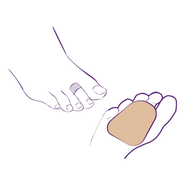 Корректор одного пальца СТ-221  Trives Корректор одного пальца СТ-221  Trives