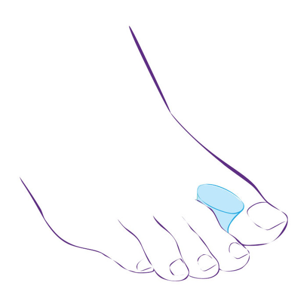 Перегородки межпальцевые увеличенного размера СТ-51  Trives Перегородки межпальцевые увеличенного размера СТ-51  Trives