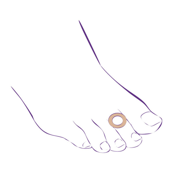 Протектор-кольцо от мозолей СТ-63  Trives Протектор-кольцо от мозолей СТ-63  Trives