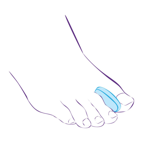 Межпальцевый вкладыш СТ-32  Trives Межпальцевый вкладыш СТ-32  Trives